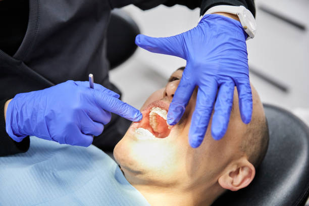 Best Chipped Tooth Repair Near Me  in Canby, MN
